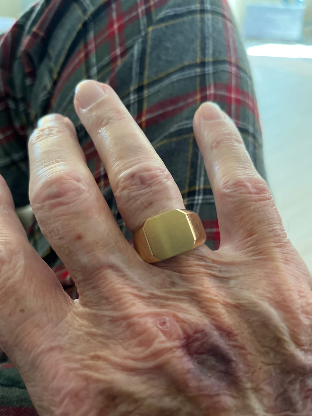 Customer photo review of Matte & Shiny Signet Ring