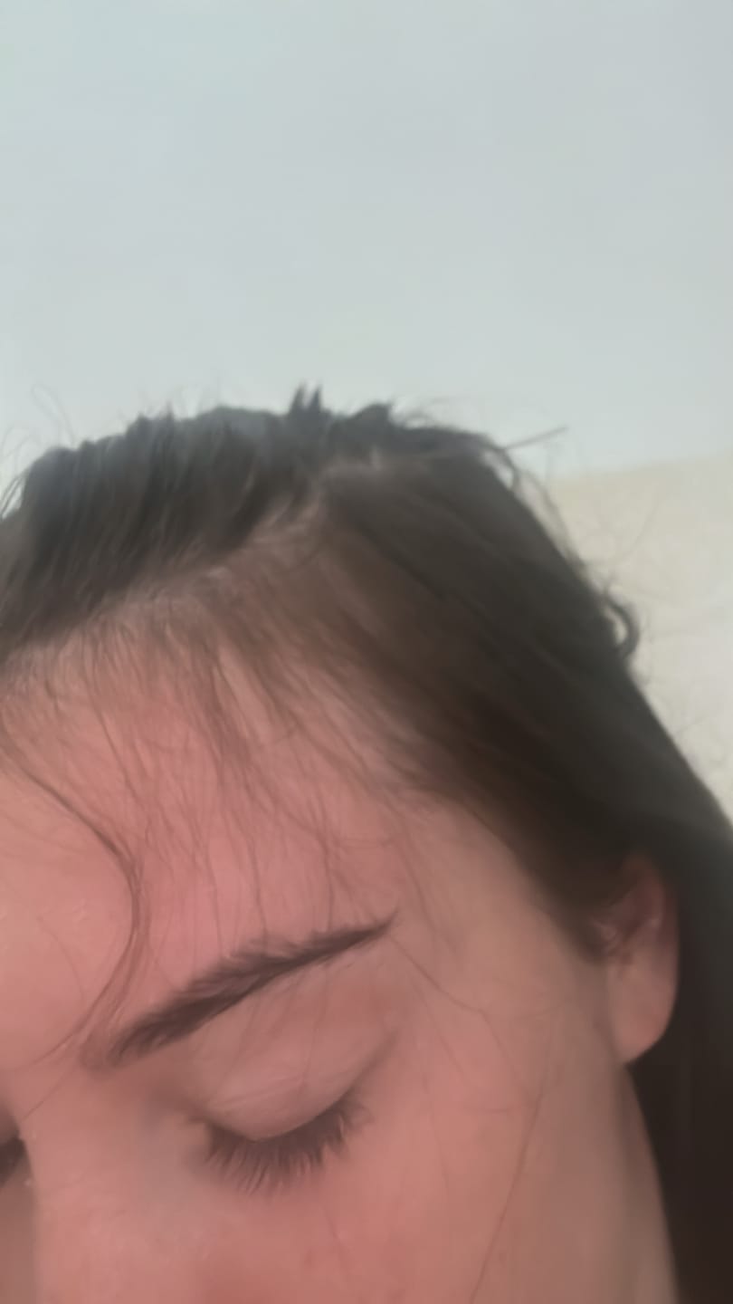 Customer photo review of Hair Growth Oil