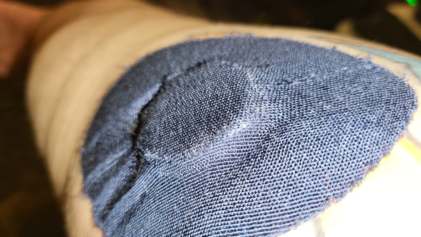 Customer photo review of Skin Grip Original - Freestyle Libre 2 & Lingo Adhesive Patches
