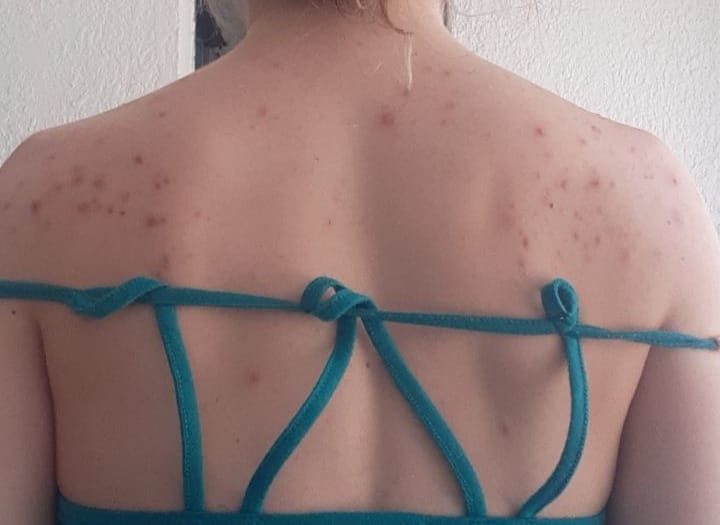 Customer photo review of Body Brightening Bundle