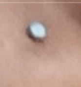 Customer photo review of 2.5mm Gem 20g Steel Nose Bone