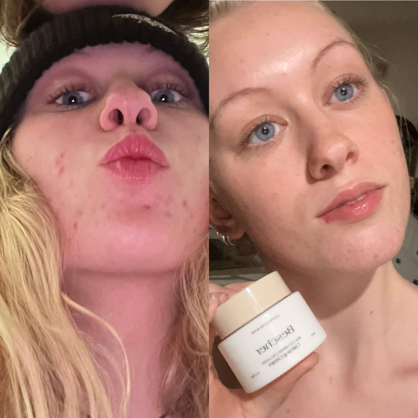 Customer photo review of Sea Cucumber Collagen Calming Cream