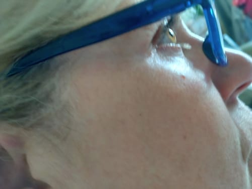 Customer photo review of LED Light Therapy Face Mask | Anti Ageing Mask