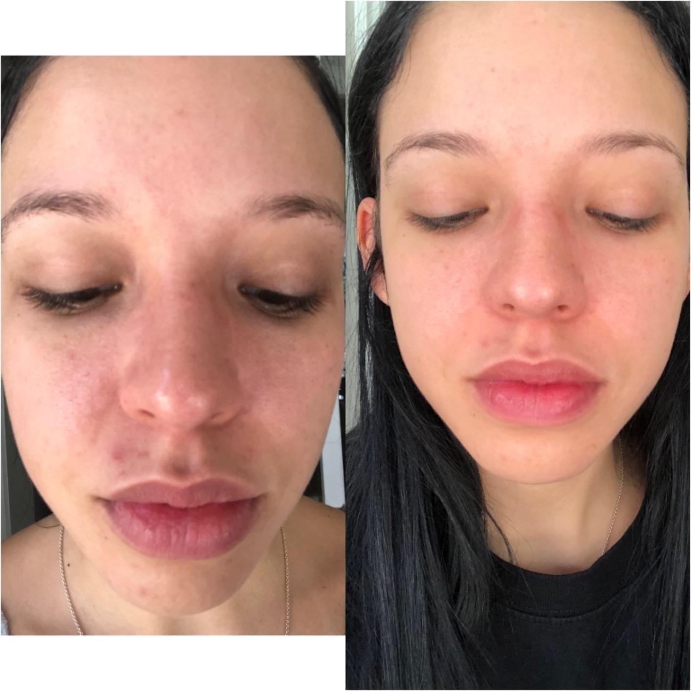 Customer photo review of SkinGlow™ Колагенов Серум