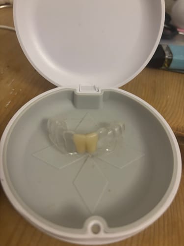Customer photo review of Missing Tooth Retainer, Instant Smile Fix