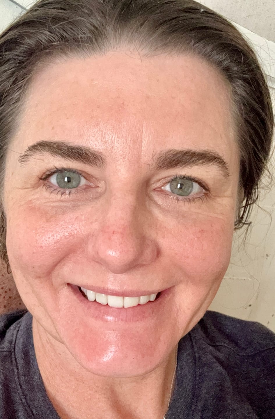 Customer photo review of Ultra Cleanse & Revive Face Scrub