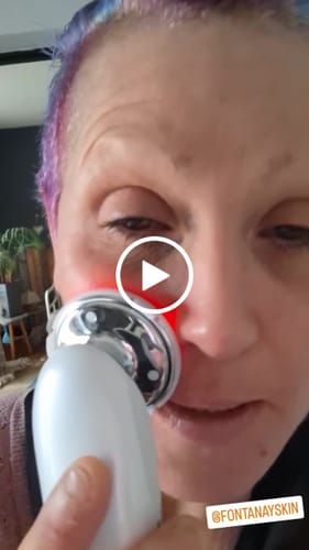 Customer video review of LightPro 7en1 Fontanay™ Lifting Luminothérapie