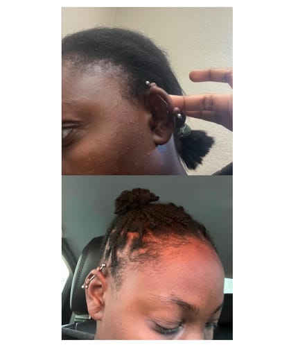 Customer photo review of Ultimate Transformation Bundle- Entire full sized hair product line at $60 off! FREE SHIPPING