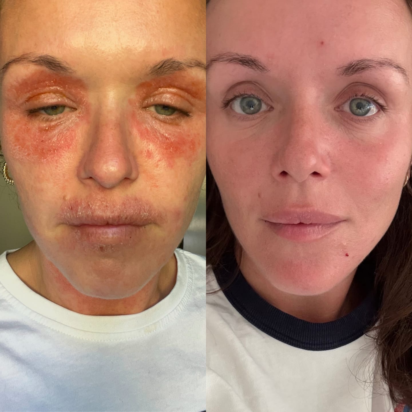 Customer photo review of Sea Cucumber Collagen Calming Cream