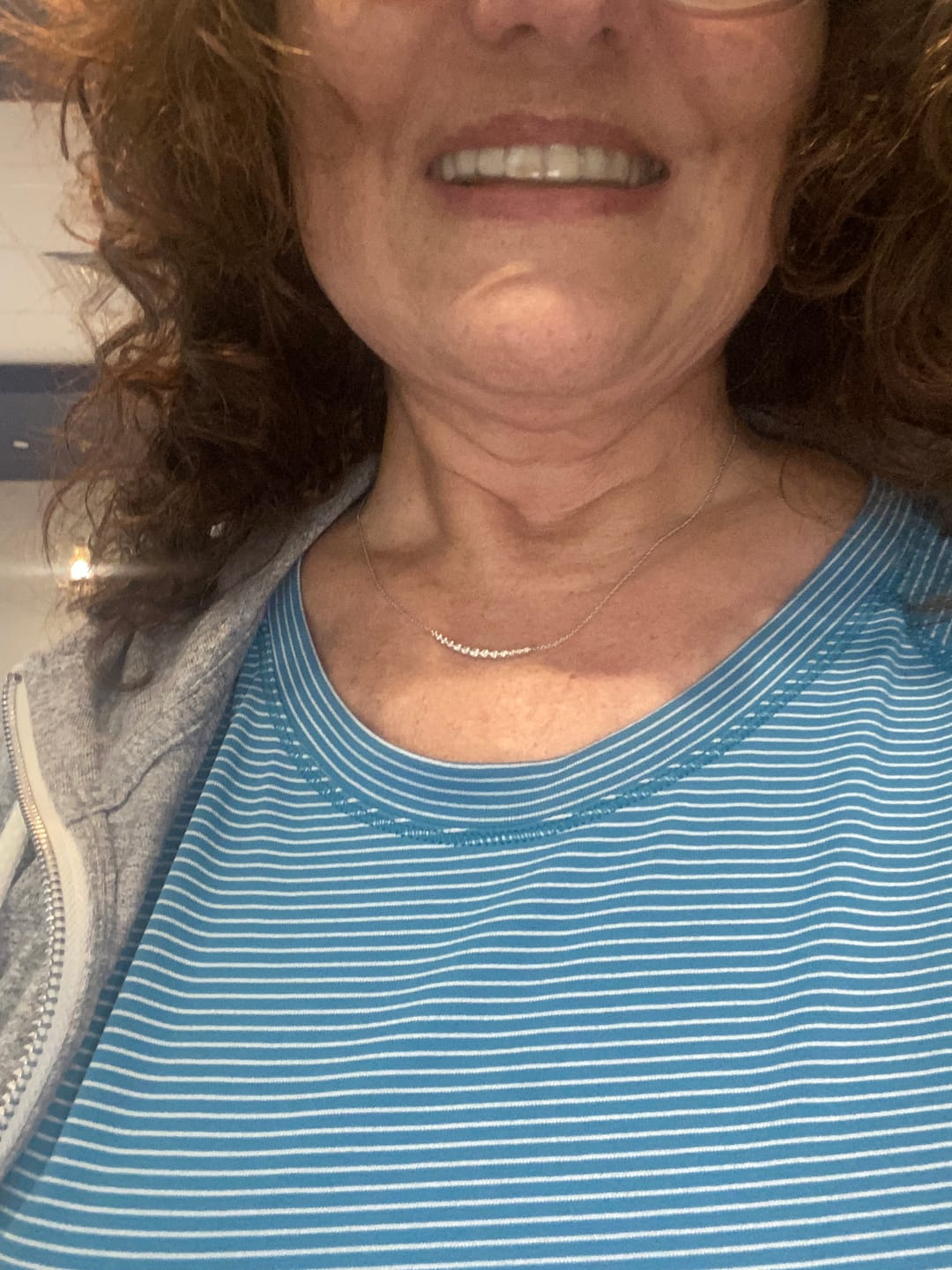 Customer photo review of 1mm Thinnest Custom Daytime Teeth Guard - Protect your Teeth Without Anyone Noticing