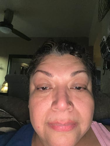 Customer photo review of Micro-Infusion anti-âge ceralyne