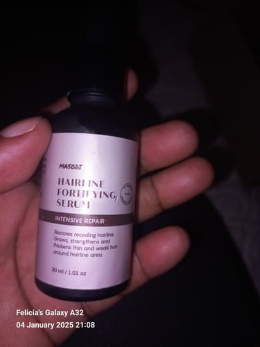 Customer photo review of Hairline Fortifying Serum 30ml
