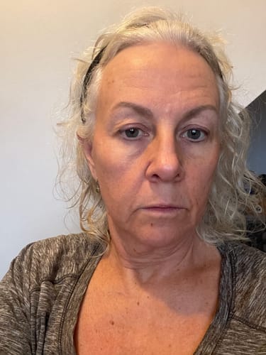 Customer photo review of Micro-Infusion anti-âge ceralyne