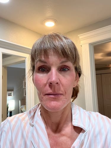 Customer photo review of Micro-Infusion anti-âge ceralyne