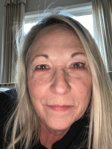 Customer photo review of Micro-Infusion anti-âge ceralyne