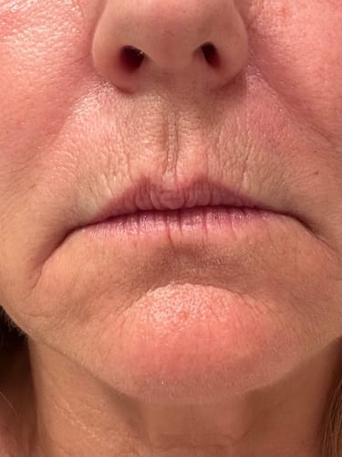 Customer photo review of Micro-Infusion anti-âge ceralyne