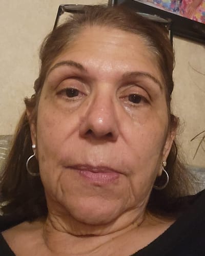 Customer photo review of Micro-Infusion anti-âge ceralyne