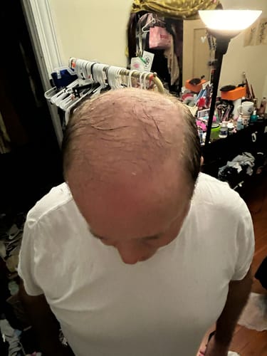 Customer photo review of Thickening Shampoo