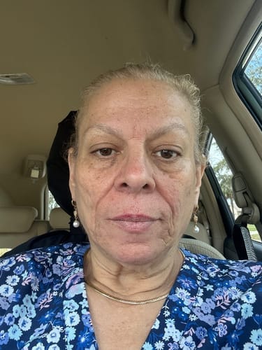 Customer photo review of Micro-Infusion anti-âge ceralyne