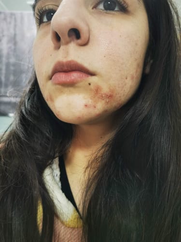 Customer photo review of Skin & Gut Maintain™