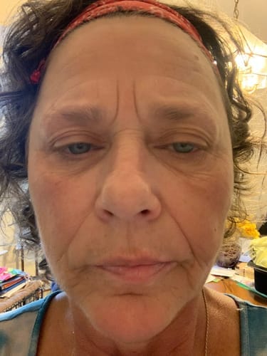 Customer photo review of Micro-Infusion anti-âge ceralyne