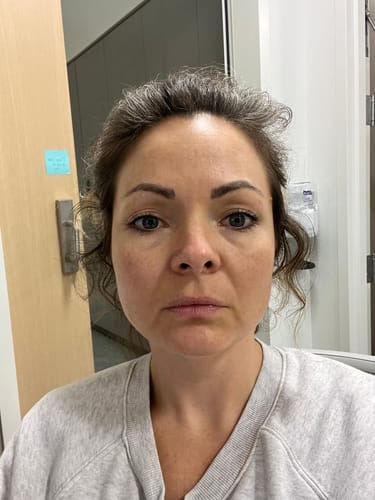 Customer photo review of Micro-Infusion anti-âge ceralyne