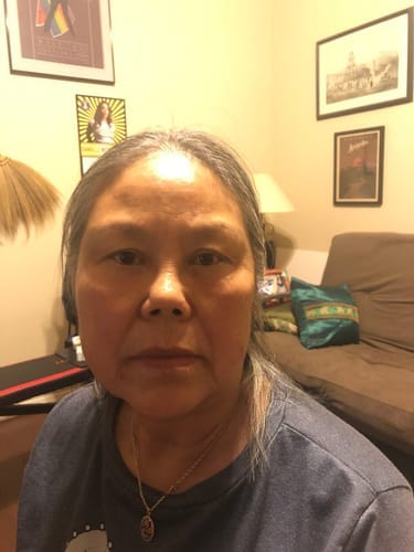 Customer photo review of Micro-Infusion anti-âge ceralyne