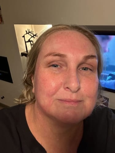 Customer photo review of Micro-Infusion anti-âge ceralyne