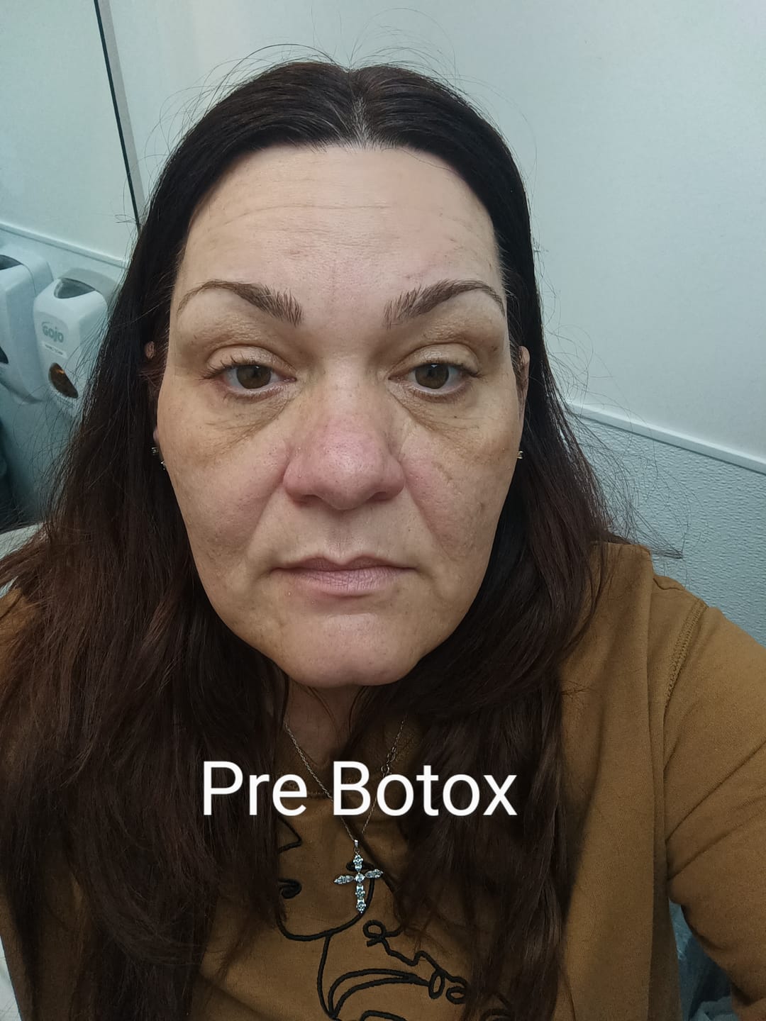 Customer photo review of Anti-Aging treatment