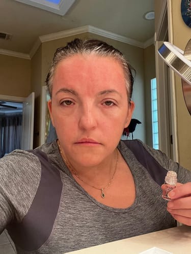 Customer photo review of Micro-Infusion anti-âge ceralyne