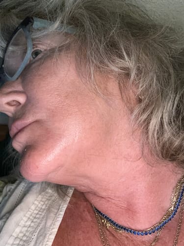 Customer photo review of 10% Niacinamide Serum