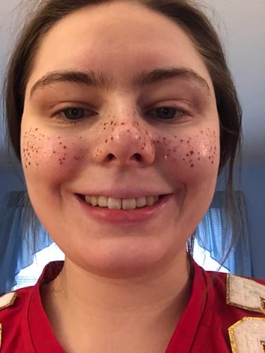 Customer photo review of Red Spirit Speckles Makeup Patches - Team Spirit Collection