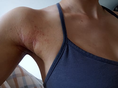 Customer photo review of קרם לחות טיפולי לעור יבש עד יבש במיוחד | CALM CREAM