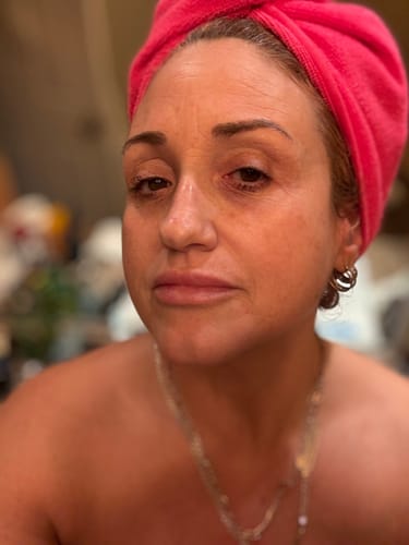 Customer photo review of 12-in-1 Micro Infusion System: Advanced Kit for 12 Professional-Grade Treatments