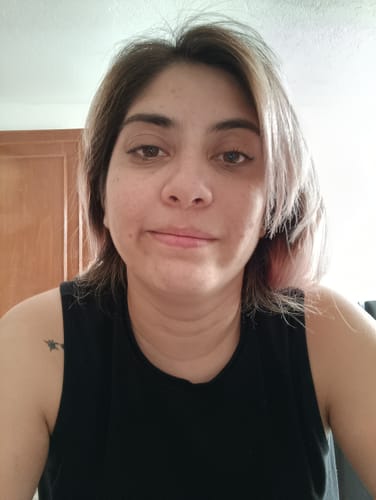 Customer photo review of NUEVO: Kit Piel Deslumbrante (47% OFF) - Limpiador + Tónico + Serum Vitamina C + Serum Niacinamida + Serum Ácido Glicólico + Serum Ácido Hialurónico + Contorno de Ojos