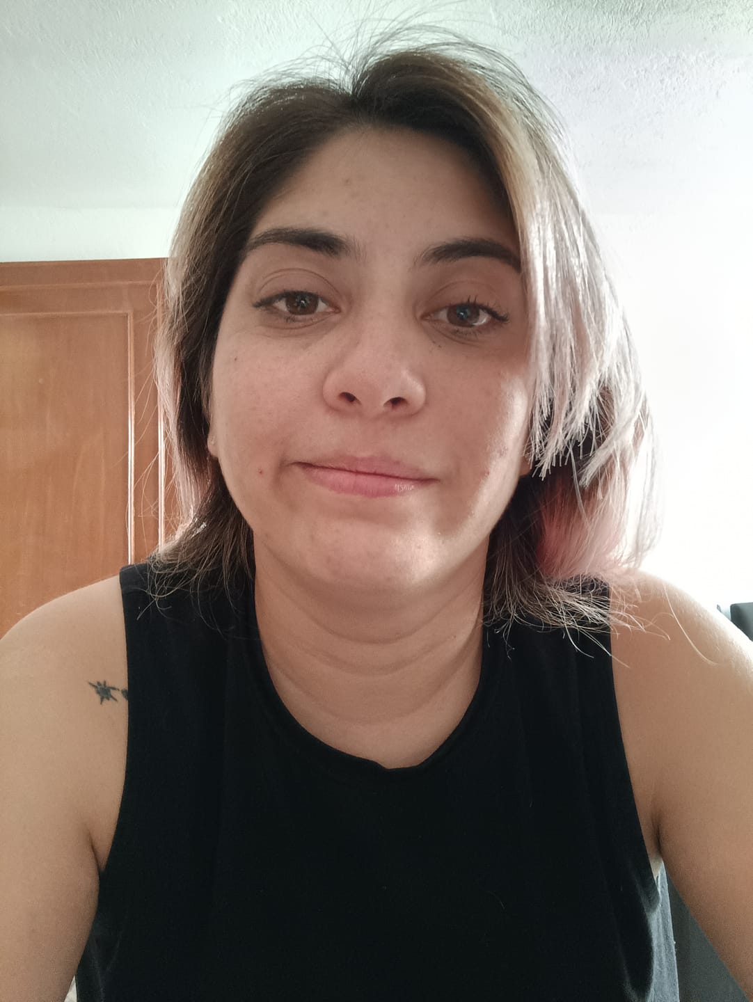 Customer photo review of NUEVO: Kit Piel Deslumbrante (47% OFF) - Limpiador + Tónico + Serum Vitamina C + Serum Niacinamida + Serum Ácido Glicólico + Serum Ácido Hialurónico + Contorno de Ojos