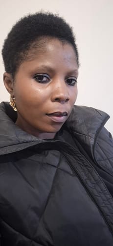 Customer photo review of Anti-Acne & Dark Spots African Soap