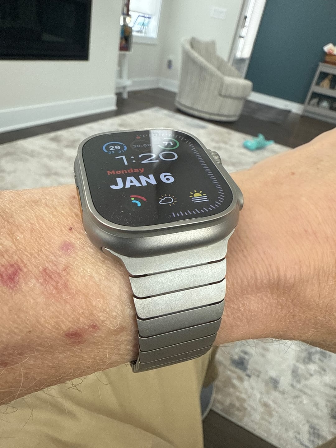 Customer photo review of Titanium Bracelet MG