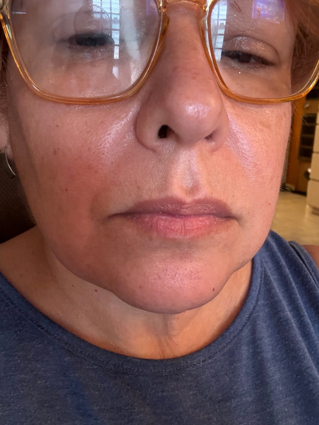 Customer photo review of Luxury Skincare Box