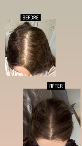 Customer photo review of Revive & Retain Scalp Spray