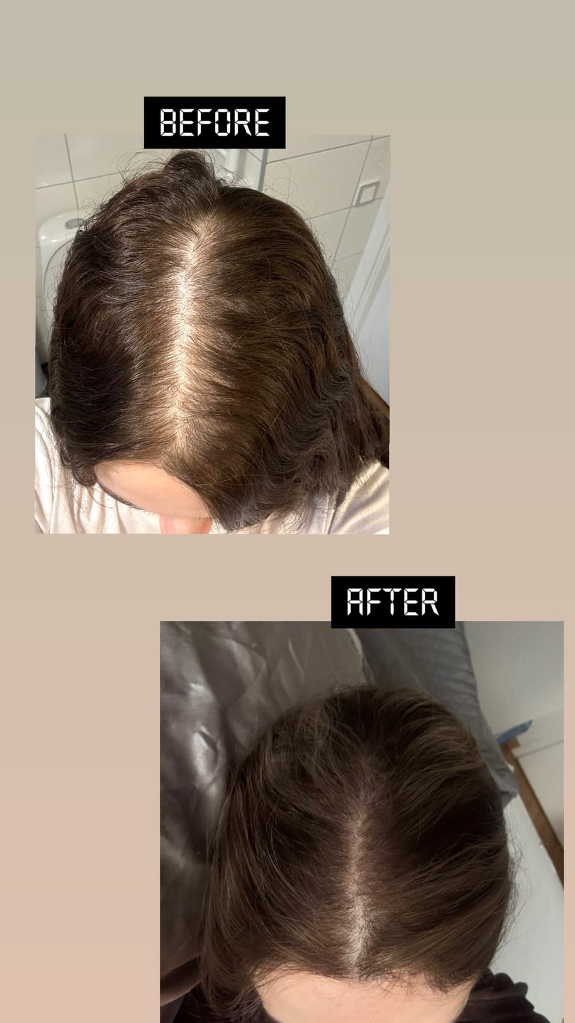 Customer photo review of Revive & Retain Scalp Spray