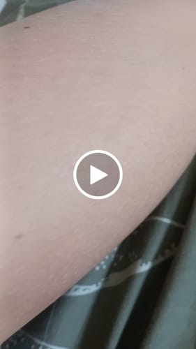 Customer video review of Depilador Nano Pro