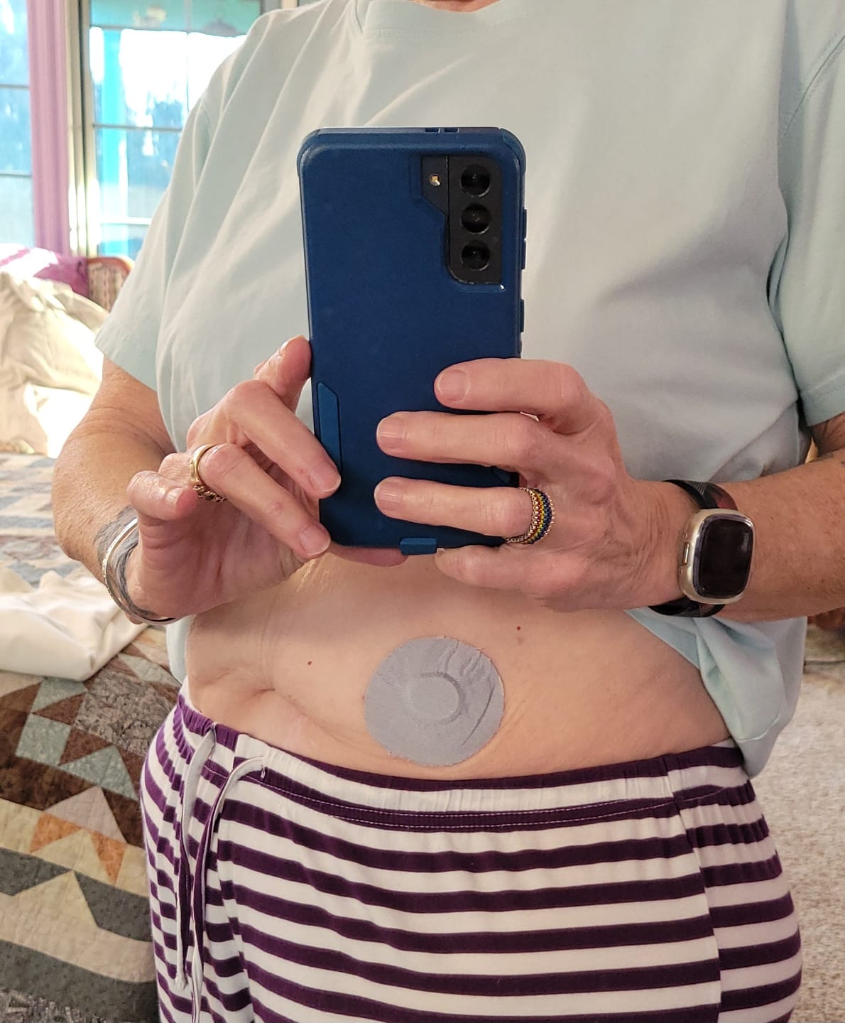 Customer photo review of Skin Grip Original - Dexcom G7 & Stelo Adhesive Patches