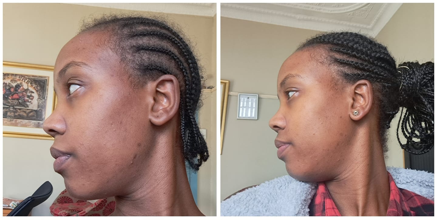 Customer photo review of Luminous Skin Glow With Collagen