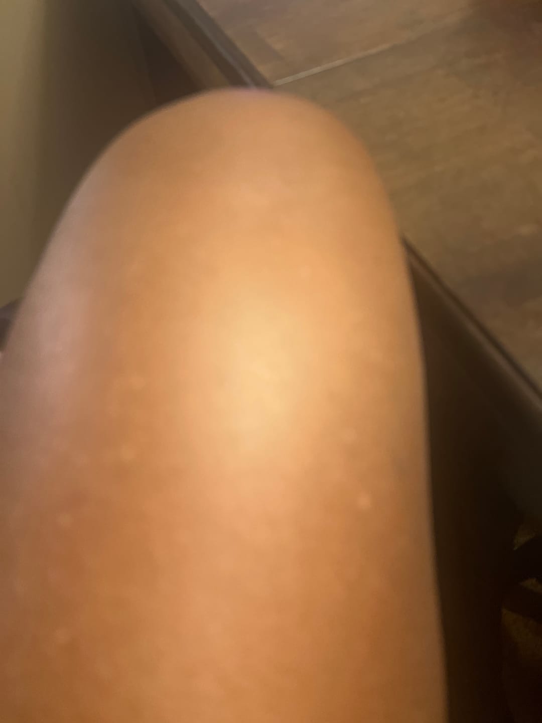 Customer photo review of Intense Discoloration Treatment (Rapid Action)