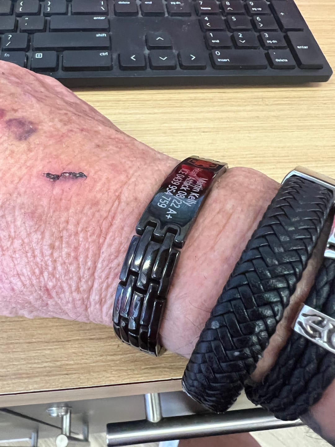 Customer photo review of Black Stainless Steel Medical Alert ID Bracelet for Men