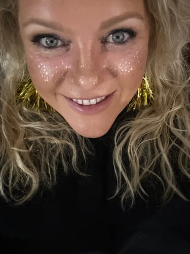 Customer photo review of Gold Glitter Freckles Makeup Patches