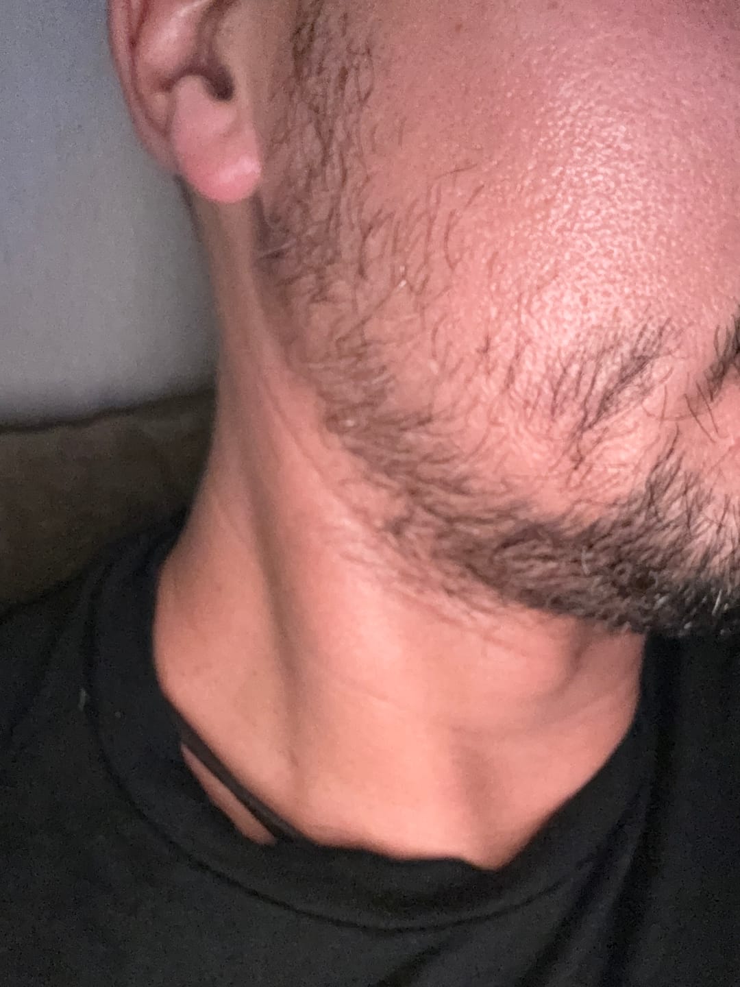 Customer photo review of Pack duo | L’Indispensable pour Stimuler la Barbe