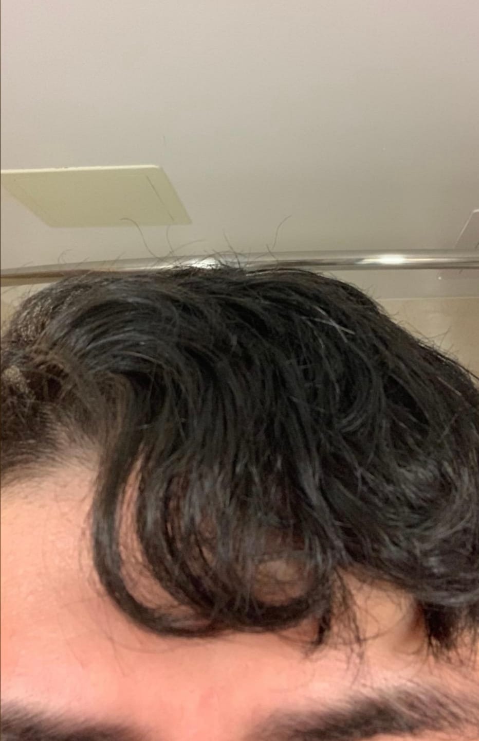 Customer photo review of Psoriasis Honey Renewing Shampoo