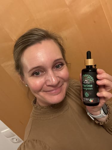 Customer photo review of Omega 3 Algenöl